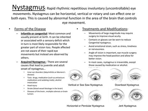 and is usually caused by a problem with the eyes themselves or with the parts of the brain . . Drugs that cause nystagmus